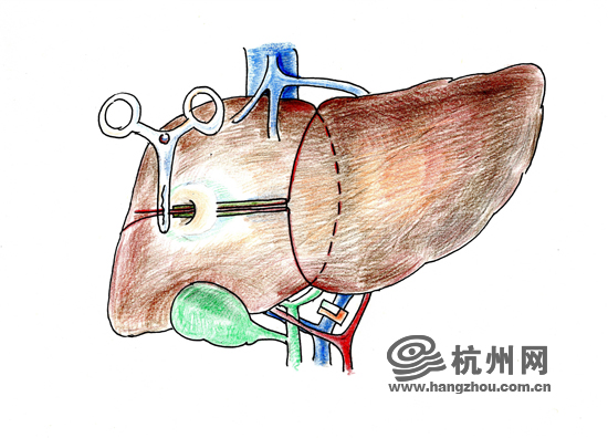 http://ori.hangzhou.com.cn/ornews/images/attachement/jpg/site2/20140926/f8b156b7bbe4158efbfb03.jpg