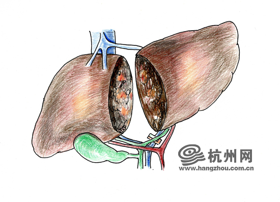 http://ori.hangzhou.com.cn/ornews/images/attachement/jpg/site2/20140926/f8b156b7bbe4158efc5304.jpg