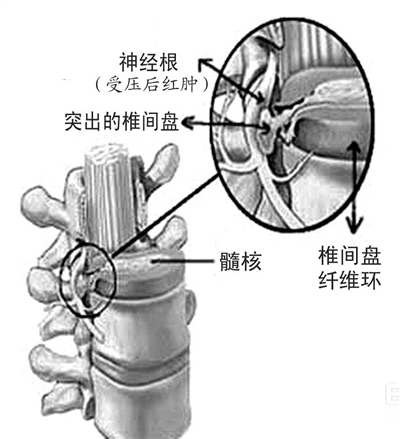 http://hzdaily.hangzhou.com.cn/dskb/media/1/3/2015-07/01/A21/res01_attpic_brief.jpg