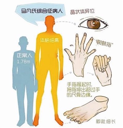 http://fs.news.hbjt.com.cn/group1/M00/08/DD/rB4AiVnnpNiAdgPYAAGKHvaxhVQ271.jpg