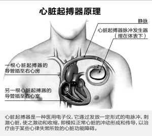 http://hzdaily.hangzhou.com.cn/dskb/media/1/3/2012-10/19/A18/res01_attpic_brief.jpg