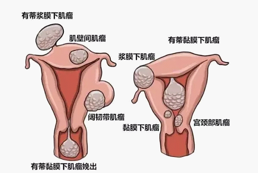 宫颈后唇图片