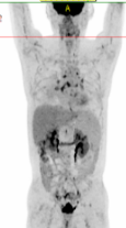 3f34c3b58d94e43229536f2f83c06e83.png 3f34c3b58d94e43229536f2f83c06e83.png